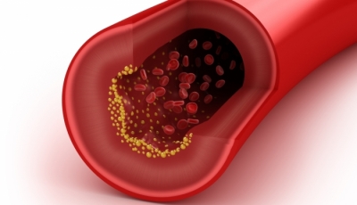 10 produktów obniżających cholesterol